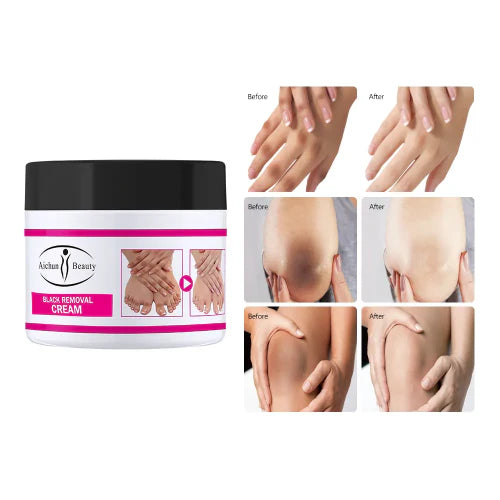 CREMA BLANQUEADORA DE ARTICULACIONES PARA ELIMINAR MANCHAS