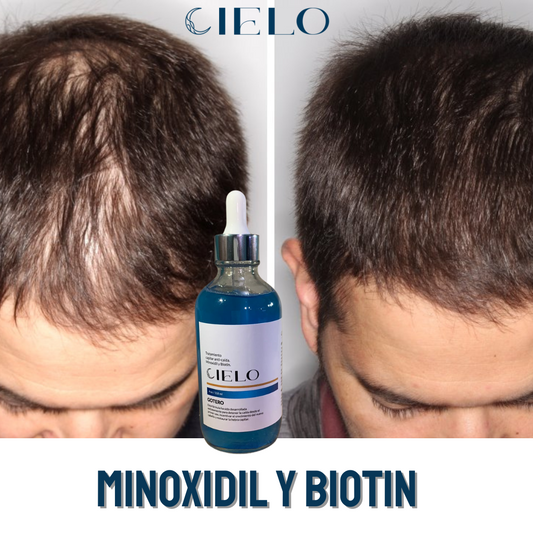 Gotero Cielo Minoxidil y Biotin- Anticaída y Crecimiento del cabello y Barba